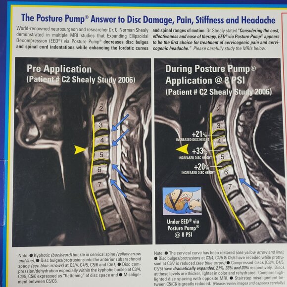 Neck Pump by Posture Pump Disc Hydrator Model 1100-SX TESTED, WORKS - Picture 9 of 13